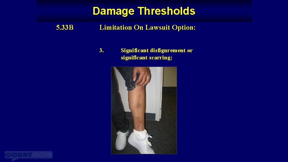 Damage Thresholds 5. 33 B Limitation On Lawsuit Option: 3. Significant disfigurement or significant