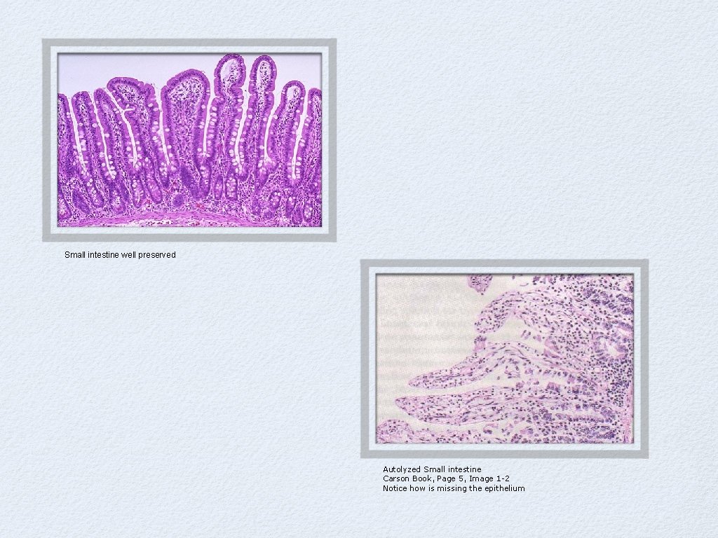 Small intestine well preserved Autolyzed Small intestine Carson Book, Page 5, Image 1 -2