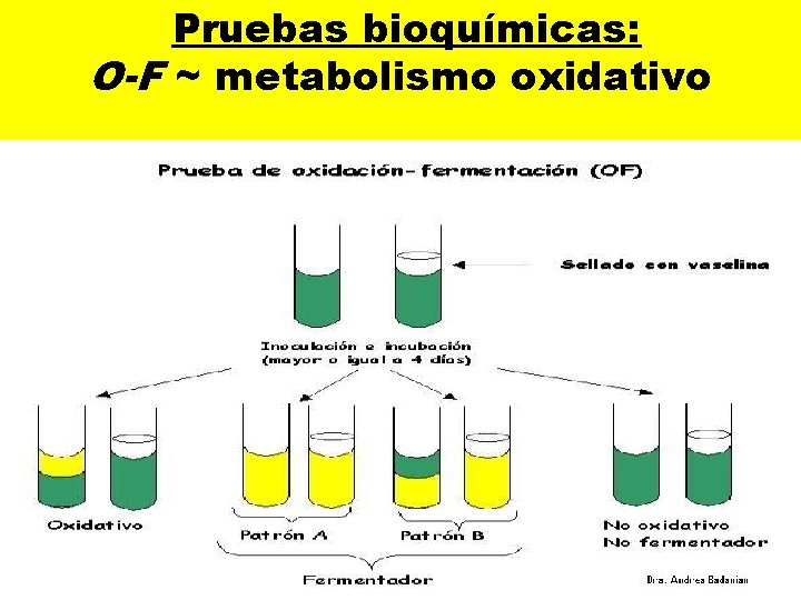  Pruebas bioquímicas: O-F ~ metabolismo oxidativo 