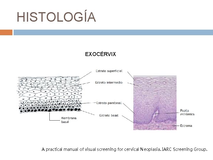 HISTOLOGÍA EXOCÉRVIX A practical manual of visual screening for cervical Neoplasia. IARC Screening Group.