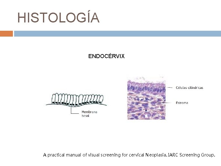 HISTOLOGÍA ENDOCÉRVIX A practical manual of visual screening for cervical Neoplasia. IARC Screening Group.