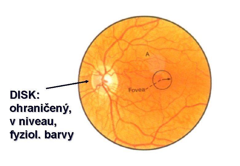 DISK: ohraničený, v niveau, fyziol. barvy 