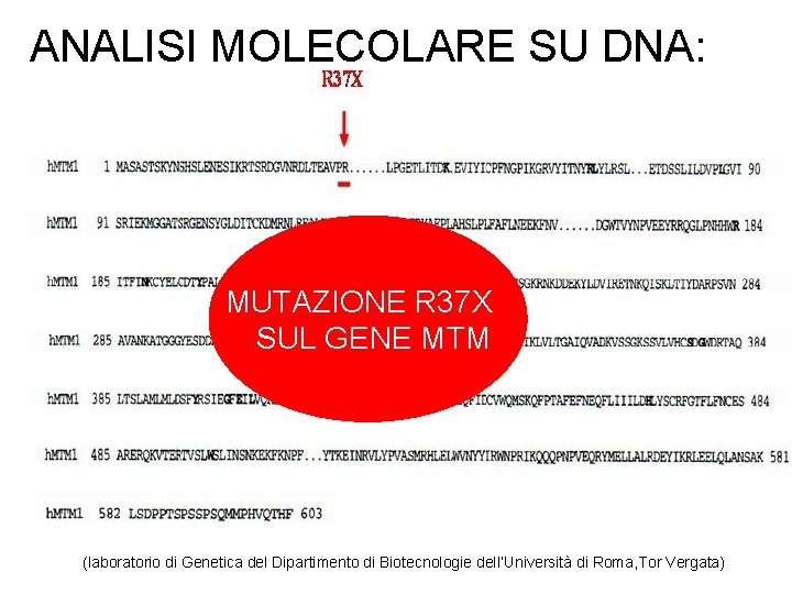 ANALISI MOLECOLARE SU DNA: MUTAZIONE R 37 X SUL GENE MTM (laboratorio di Genetica