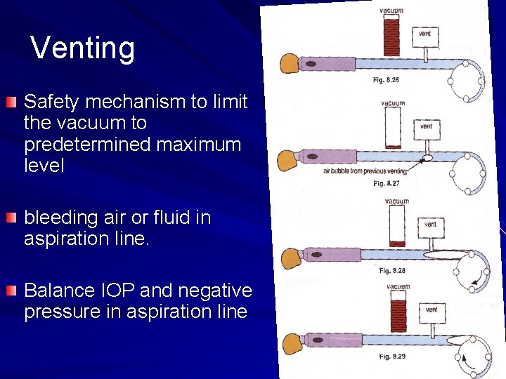 Venting Safety mechanism to limit the vacuum to predetermined maximum level bleeding air or
