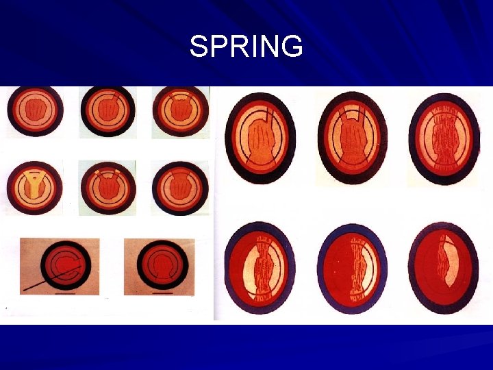 SPRING 
