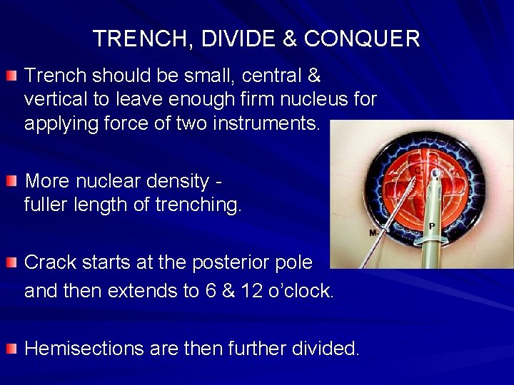 TRENCH, DIVIDE & CONQUER Trench should be small, central & vertical to leave enough