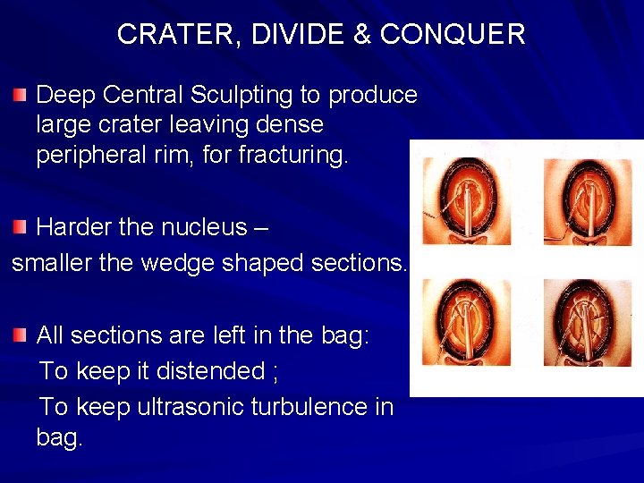 CRATER, DIVIDE & CONQUER Deep Central Sculpting to produce large crater leaving dense peripheral