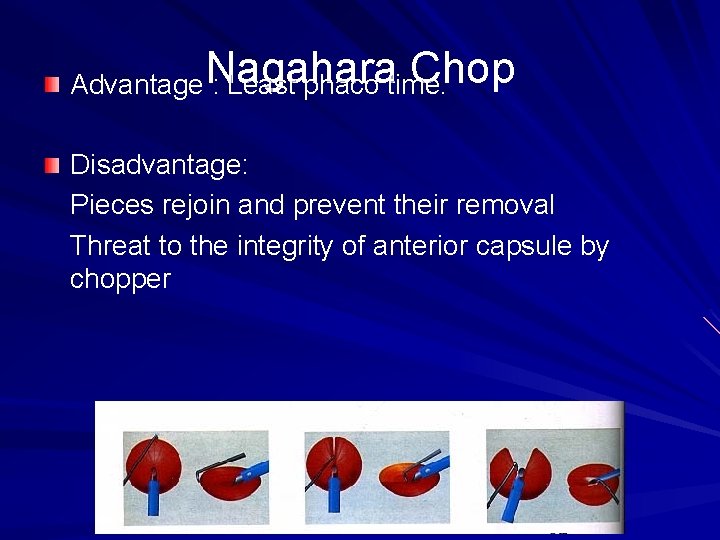 Chop Advantage. Nagahara : Least phaco time. Disadvantage: Pieces rejoin and prevent their removal