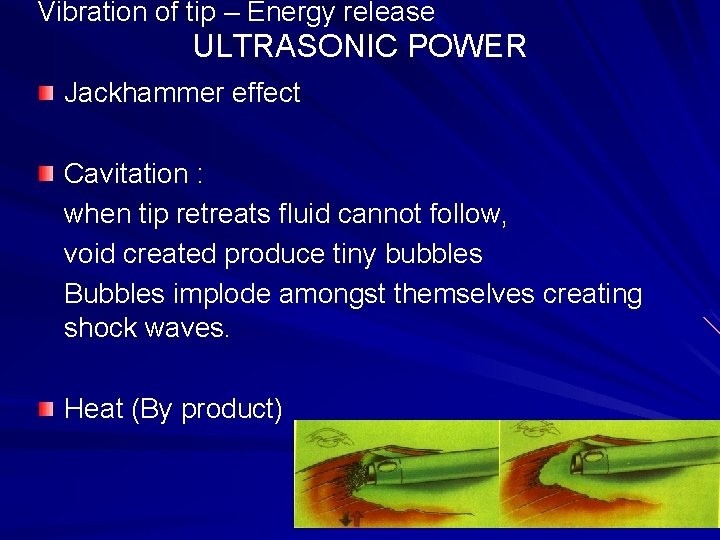 Vibration of tip – Energy release ULTRASONIC POWER Jackhammer effect Cavitation : when tip