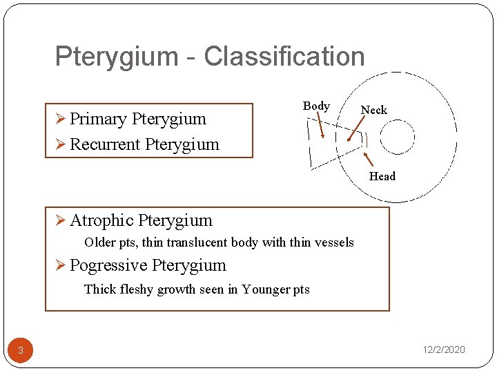 Pterygium - Classification Ø Primary Pterygium Body Neck Ø Recurrent Pterygium Head Ø Atrophic