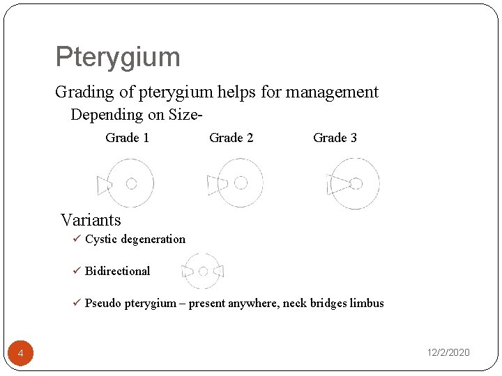 Pterygium Grading of pterygium helps for management Depending on Size. Grade 1 Grade 2