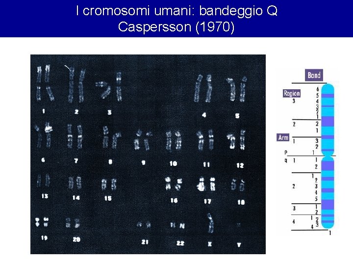 I cromosomi umani: bandeggio Q Caspersson (1970) I cromosomi umani: bandeggio Q Caspersson (1970)