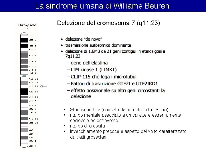 La sindrome umana di Williams Beuren Delezione del cromosoma 7 (q 11. 23) • La sindrome umana di Williams Beuren Delezione del cromosoma 7 (q 11. 23) •