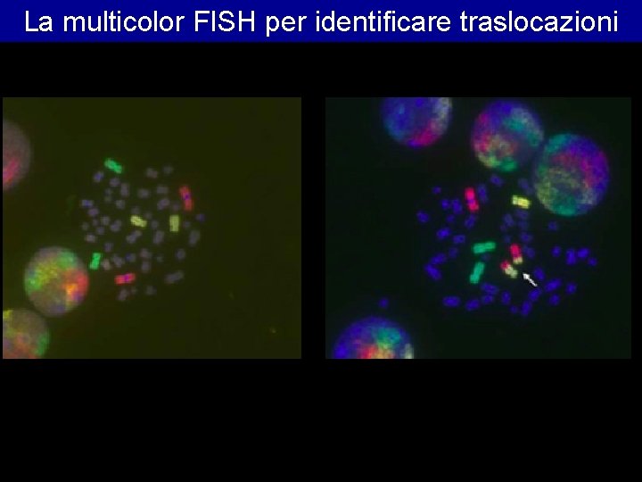 La multicolor FISH per identificare traslocazioni La multicolor FISH per identificare traslocazioni
