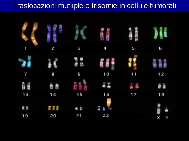 Traslocazioni mutliple e trisomie in cellule tumorali Traslocazioni mutliple e trisomie in cellule tumorali