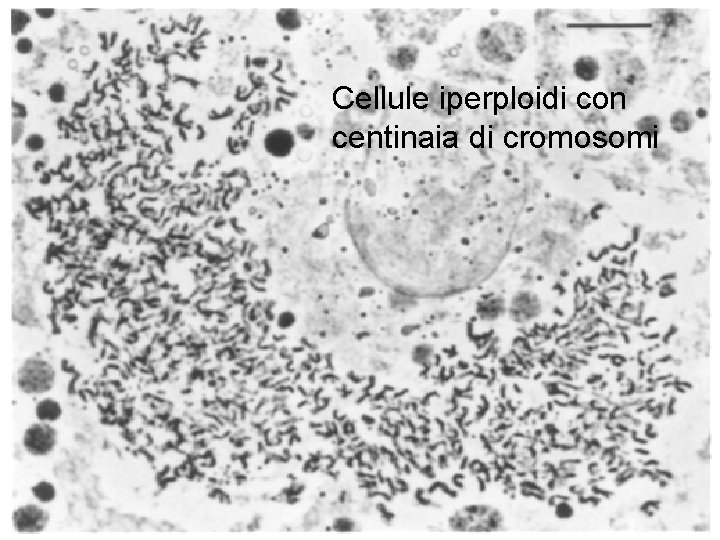 Cellule iperploidi con centinaia di cromosomi Cellule iperploidi con centinaia di cromosomi