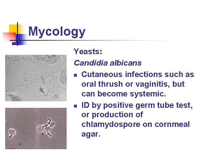 Mycology Yeasts: Candidia albicans n Cutaneous infections such as oral thrush or vaginitis, but