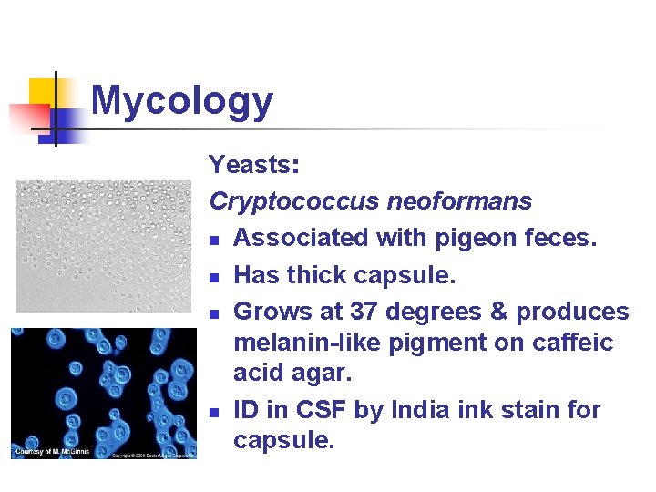 Mycology Yeasts: Cryptococcus neoformans n Associated with pigeon feces. n Has thick capsule. n