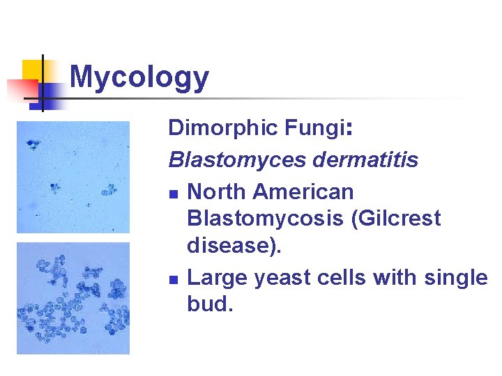 Mycology Dimorphic Fungi: Blastomyces dermatitis n North American Blastomycosis (Gilcrest disease). n Large yeast