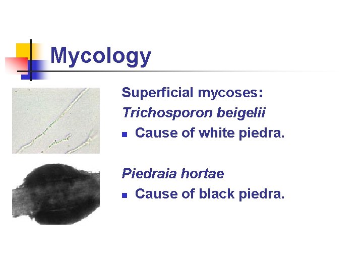 Mycology Superficial mycoses: Trichosporon beigelii n Cause of white piedra. Piedraia hortae n Cause