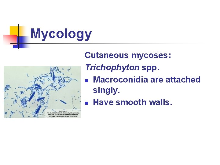Mycology Cutaneous mycoses: Trichophyton spp. n Macroconidia are attached singly. n Have smooth walls.