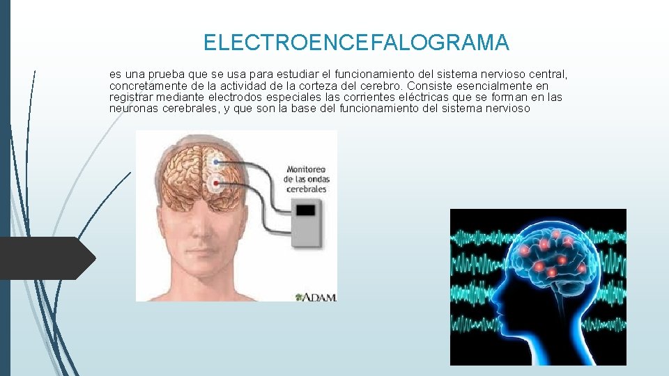 ELECTROENCEFALOGRAMA es una prueba que se usa para estudiar el funcionamiento del sistema nervioso