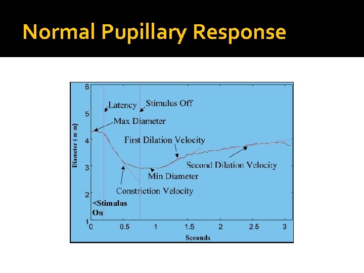 Normal Pupillary Response Normal Pupillary Response