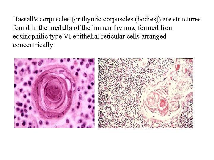 Hassall's corpuscles (or thymic corpuscles (bodies)) are structures found in the medulla of the