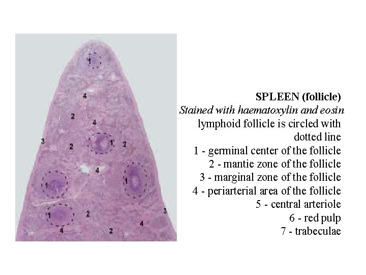 SPLEEN (follicle) Stained with haematoxylin and eosin lymphoid follicle is circled with dotted line