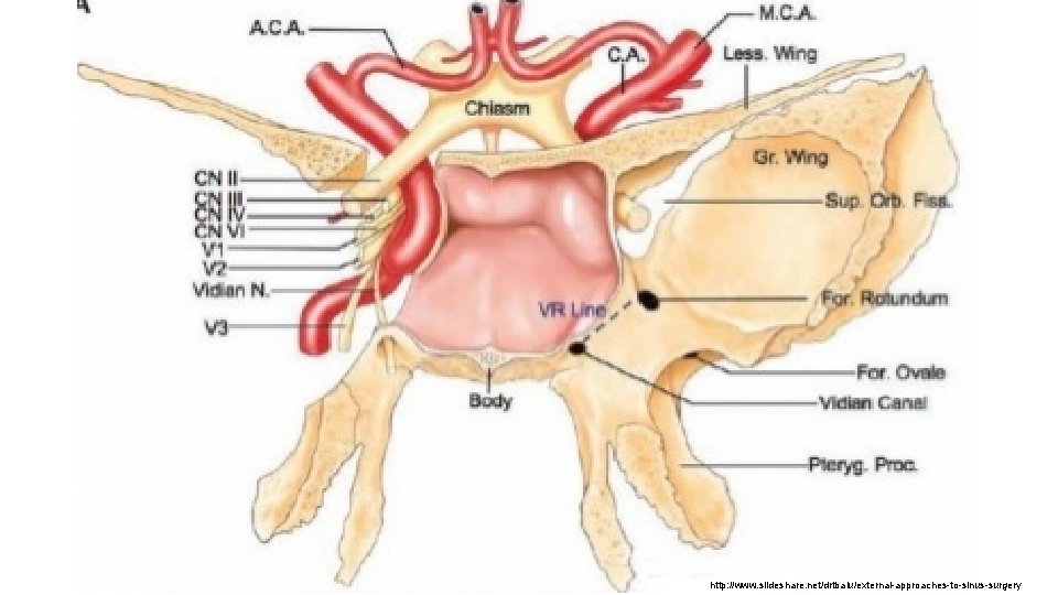 http: //www. slideshare. net/drtbalu/external-approaches-to-sinus-surgery 