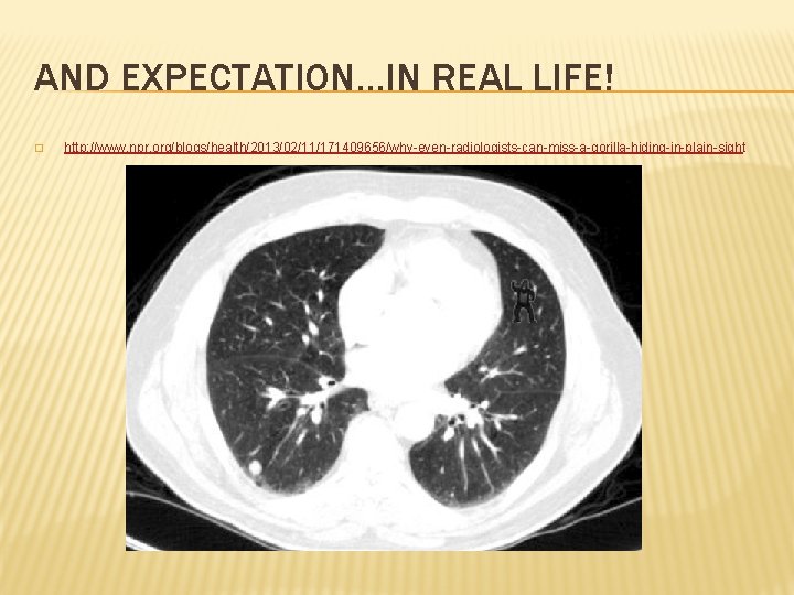 AND EXPECTATION…IN REAL LIFE! � http: //www. npr. org/blogs/health/2013/02/11/171409656/why-even-radiologists-can-miss-a-gorilla-hiding-in-plain-sight 