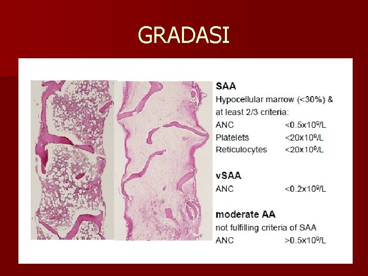 GRADASI 