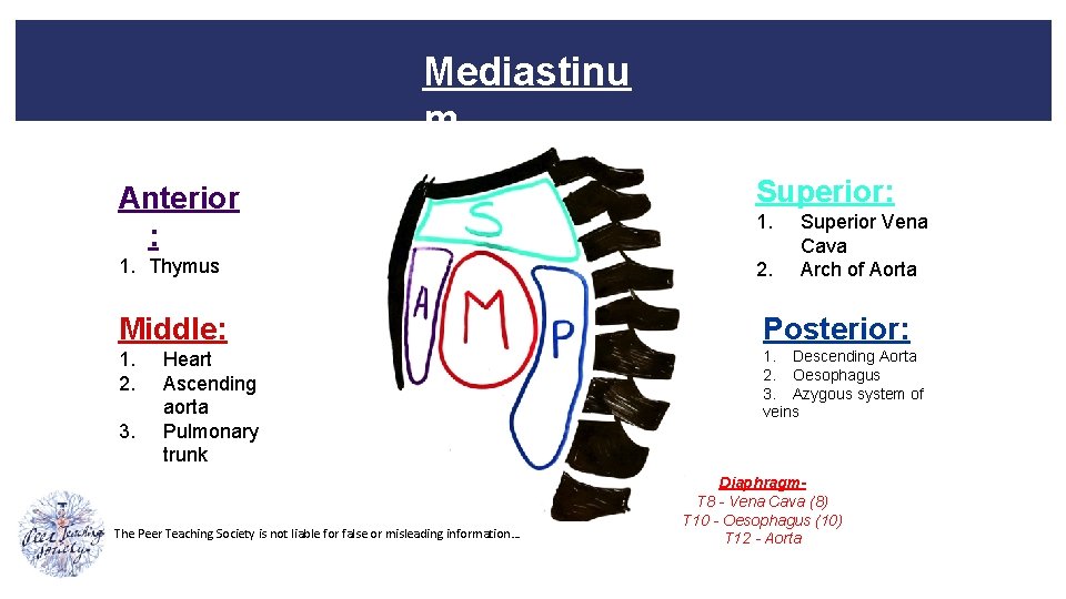 Mediastinu m Anterior : Superior: 1. Thymus 2. 1. Superior Vena Cava Arch of