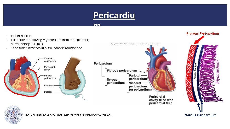 Pericardiu m Fibrous Pericardium The Peer Teaching Society is not liable for false or