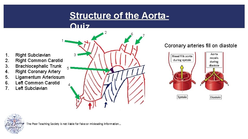 Structure of the Aorta. Quiz 2 6 7 1 Coronary arteries fill on diastole