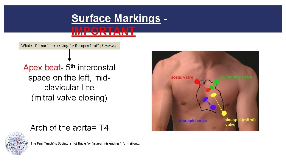 Surface Markings - IMPORTANT What is the surface marking for the apex beat? (3