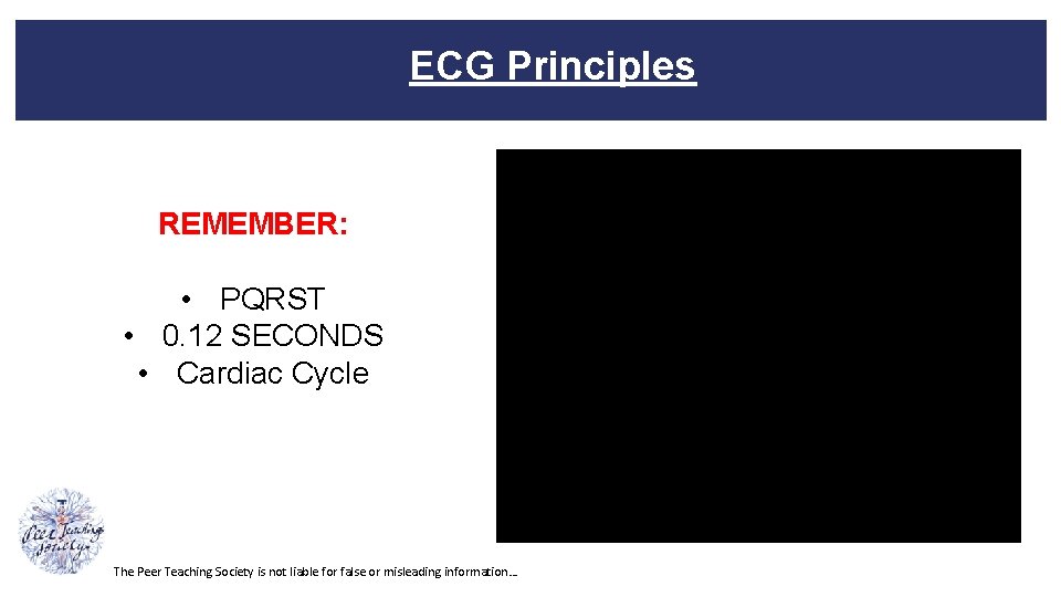 ECG Principles REMEMBER: • PQRST • 0. 12 SECONDS • Cardiac Cycle The Peer