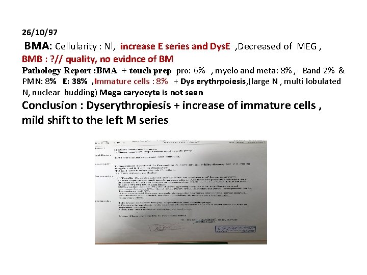 26/10/97 BMA: Cellularity : Nl, increase E series and Dys. E , Decreased of