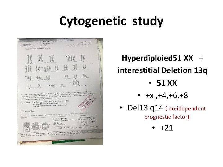 Cytogenetic study Hyperdiploied 51 XX + interestitial Deletion 13 q • 51 XX •