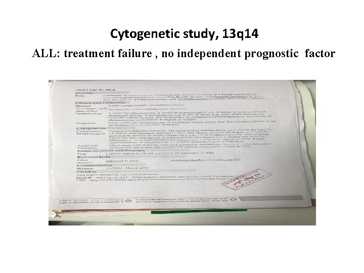  Cytogenetic study, 13 q 14 ALL: treatment failure , no independent prognostic factor