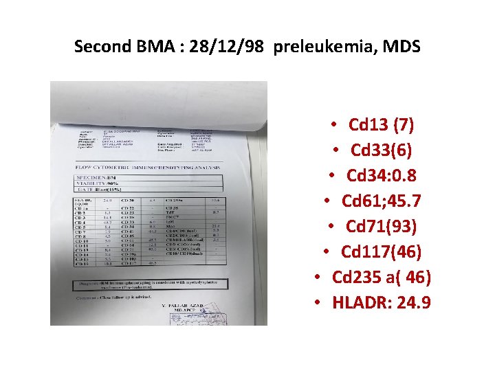 Second BMA : 28/12/98 preleukemia, MDS • Cd 13 (7) • Cd 33(6) •