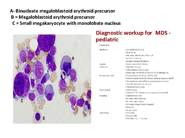 A‐ Binucleate megaloblastoid erythroid precursor B = Megaloblastoid erythroid precursor C = Small megakaryocyte