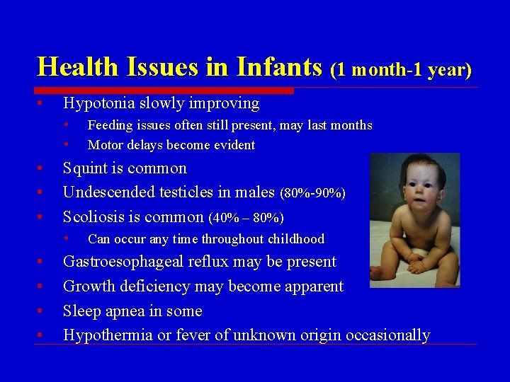 Health Issues in Infants (1 month-1 year) • Hypotonia slowly improving • • •