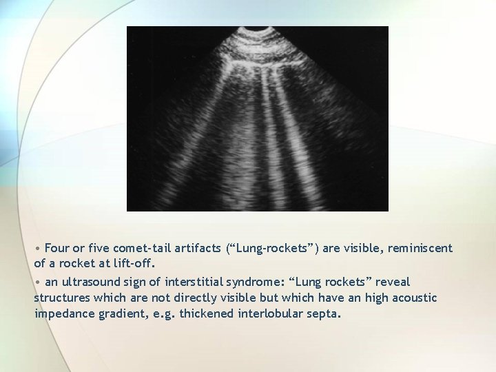  • Four or five comet-tail artifacts (“Lung-rockets”) are visible, reminiscent of a rocket