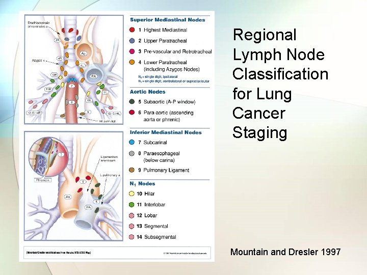 Regional Lymph Node Classification for Lung Cancer Staging Mountain and Dresler 1997 