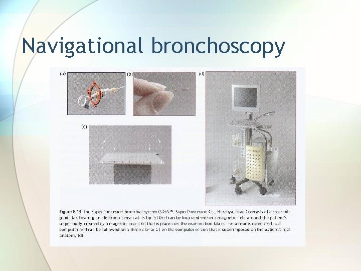 Navigational bronchoscopy 