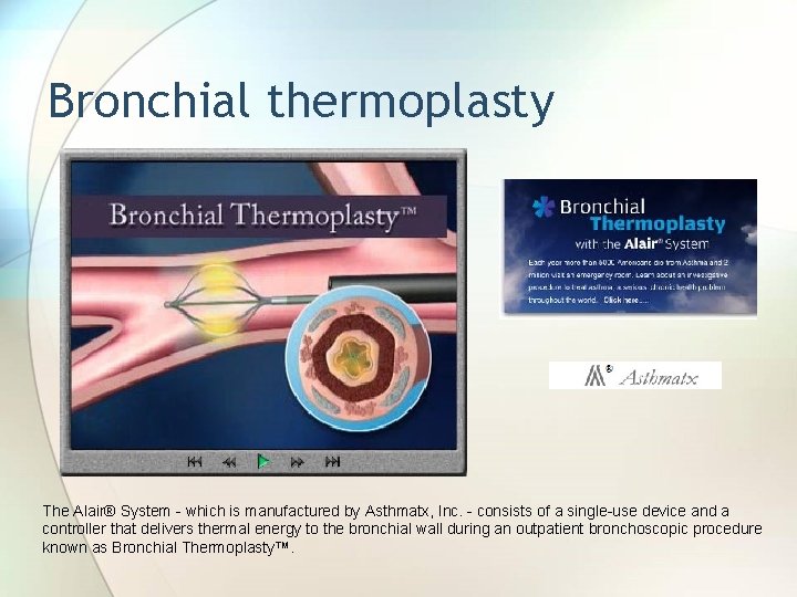 Bronchial thermoplasty The Alair® System - which is manufactured by Asthmatx, Inc. - consists