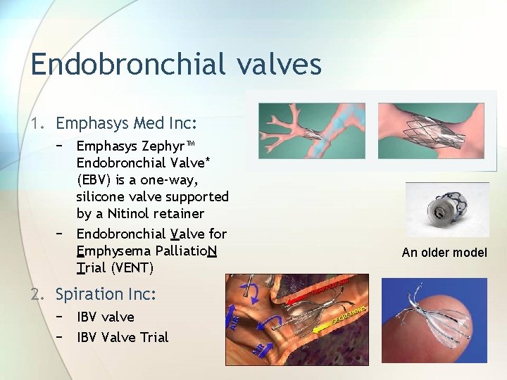 Endobronchial valves 1. Emphasys Med Inc: − Emphasys Zephyr™ Endobronchial Valve* (EBV) is a