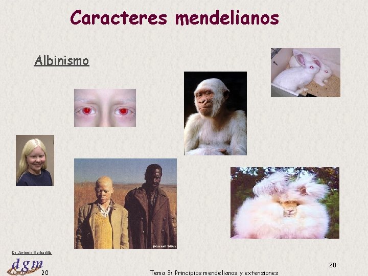 Caracteres mendelianos Albinismo Dr. Antonio Barbadilla 20 Tema 3: Principios mendelianos y extensiones 20 Caracteres mendelianos Albinismo Dr. Antonio Barbadilla 20 Tema 3: Principios mendelianos y extensiones 20