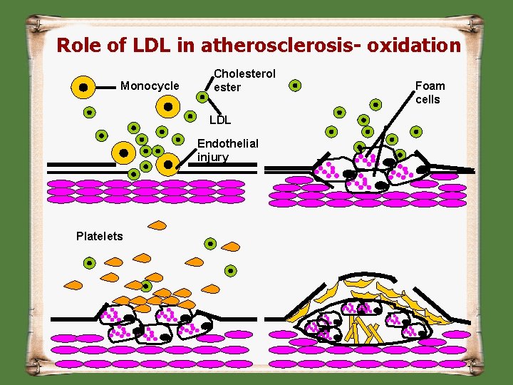 Role of LDL in atherosclerosis- oxidation Monocycle Cholesterol ester LDL Endothelial injury Platelets Foam